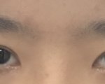 [내가최고임] 나보다 <b>비대칭</b> 심한사람 있어?