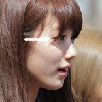수지도 눈 끝이랑 머리카락 있는쪽이랑 <b>간격</b> 먼데...