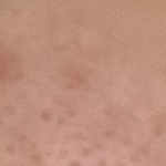 나 피부 ㅁㅌㅊ?