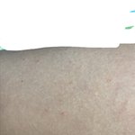 [이것좀봐줘] 팔털 손가락털 뽑는거 중<b>독임</b>