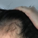 굶어서 빼는 거 개무식한거임 탈<b>모르</b> 파티 ㅆㄱㄴ