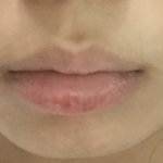 [조언부탁해] 턱짧은 <b>무턱</b>에 인중길어서 개슬픔