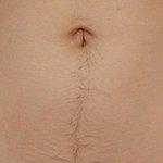 [19] 혐주의) 몸에 나만 이럼?