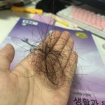 [댓글부탁해] 이거 탈모임?