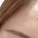 그냥 써보는 <b>쌍수</b>후기! 다들 공유해보자