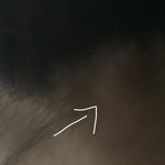 목뒤에 여드름? <b>멍울</b>?같은거 생기는 애들없냐