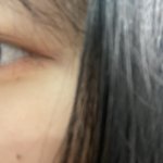 [드루와] 쌍수를 할까말까 추반이라도 해주세요 선생님들 ,,