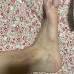 [<b>미방</b>없음] 개 징그러운데 볼사람