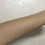 얘드라 나 어떠캄 <b>몸</b>에 <b>막</b> 반점이 올라와