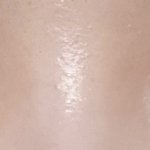 [이것좀봐줘] 나 <b>짝눈</b>인데 쌍수할까 말까 너무고민돼ㅠㅠ봐줘여러분...