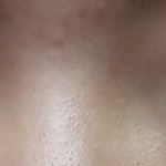 [정말궁금해] <b>내</b> <b>눈</b> 쌍수하면 용 될 <b>눈</b>인지 좀 봐줘