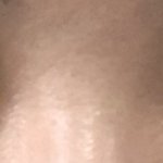 방금 쌍수하고 나왔는데 어떰?