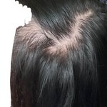 [댓글부탁해] 나 탈모임? 진짜 심각해 다 들어와줘