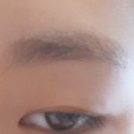 [19] 성형없이 안검하수가 <b>무쌍</b>큰눈 되는법