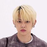 연준 목에 이 <b>상처</b> 뭘까? 수빈도 비슷하게 있던데
