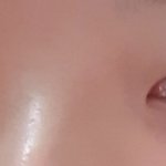 뜨끈뜨끈한 쌍수 후기ㅋㅋㅋㅋ(약혐