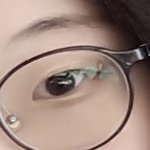 [댓글부탁해] 쌍수 전후