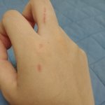 고영이한테 깝치다 <b>긁힘</b>