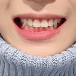 [NCT] 이 아이의 입동굴과 피곤할때 나오는 <b>짝눈</b>을 좋아하는편.