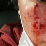 [방탈죄송] 글 수정합니다.