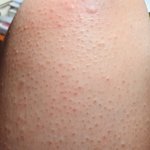 나 진짜 ㅈㄹ 심각하지 않아?.. 혐주의