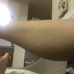 나보다 종아리살 많은사람 못봄