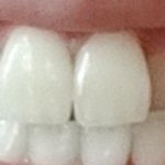 [댓글부탁해] 교정하고 <b>라미</b>해야될거같음?