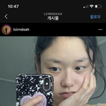 나 진짜 다크<b>서클</b> 이렇게 심하거든
