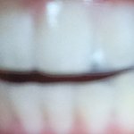 녕안 친구들 나 셀프 치아 <b>미백</b> 하는 중~