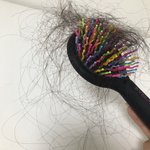 야 머리 이정도 빠지는게 <b>정상</b>임??