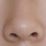 코수술 해야 되나요?