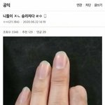 [드루와] 한남 오열...군<b>복무</b>하다 손가락 잘린 군인