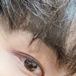 [댓글부탁해] 열일곱 살 <b>남자</b>인데 <b>쌍수</b> 할까 말까