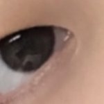 이런 몽고<b>주름</b> 앞트임 하면 없어짐?