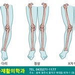 이게 ㄹㅇ 제일 최악의 체형임
