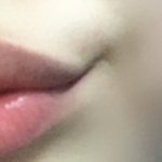 나처럼 웃을때 이런거 생기는사람