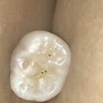 나 빠진 <b>이로</b> 실험하려고 하는데 실험추천좀해줘