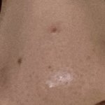 어떡하지ㅜㅜ 엄청 큰거 생겼어 조금 역겨우니까 비<b>위약</b>하면 들어오지망...