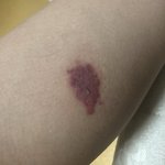 나 다리에 젖꼭지 생겼는데 볼래