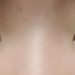 [댓글부탁해] 눈 <b>겉쌍</b>? 속<b>쌍</b>? 알려주라