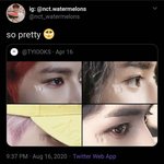 [NCT] 태용이 <b>흉터</b>