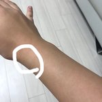 [이것좀봐줘] 팔이 아픈데 이거 <b>인대</b> 늘어난건가