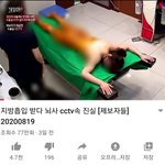 <b>성형영상</b>보는데