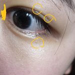 [이것좀봐줘] 눈에 이거어케 없애ㅠㅠㅠㅠㅠ