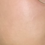 나 피부 어때 <b>사진</b>있어 사람에따라 <b>약</b>혐일수도 있어