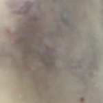 실<b>마진</b> 연고 원라 이럼?