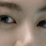 정국 이거 눈성형<b>흉터</b>야?