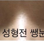 쌍수 잘되는 봐주세요