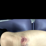 [힘이되어줘] 기자분들 계신가요.제 무릎을 돌려주세요/ 공유킥보드사고