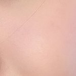 [약혐] 나 <b>피부</b> 안좋아진거봐 <b>개</b>스트레스받네